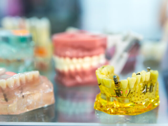 Eksik Dişler Çene Kemiğini Nasıl Etkiler? Protez ve İmplant Çözümleri