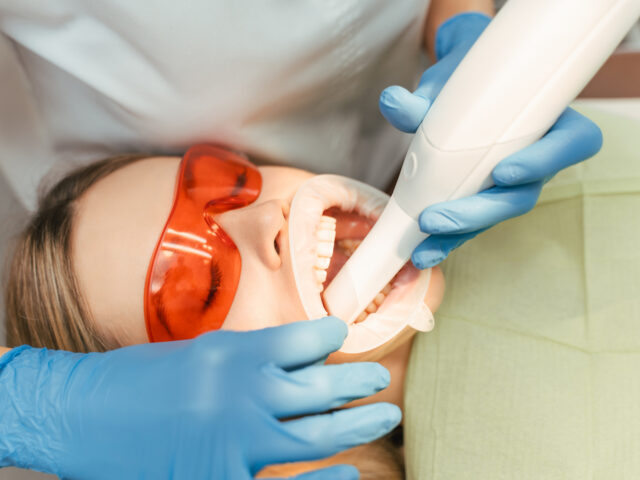 Diş Eti Lazer Tedavisi Ağrısız ve Hızlı İyileşme Sağlar mı?