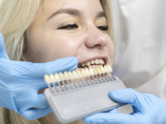 Zirkonyum Diş Kaplamaları Hakkında Merak Edilenler