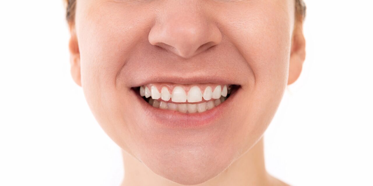 Diş Kaplama ve Gülüş Tasarımında Merak Edilenler