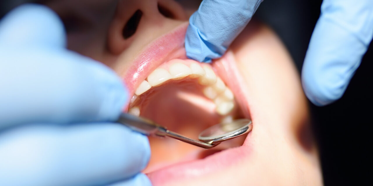 Kanal Tedavisi Sonrası Diş Kırılır mı?