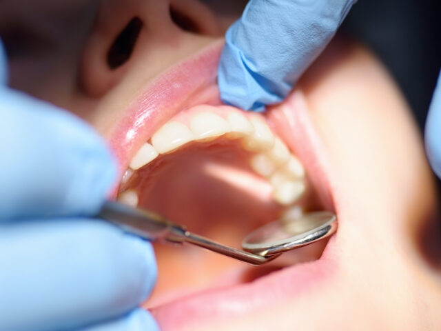 Kanal Tedavisi Sonrası Diş Kırılır mı?