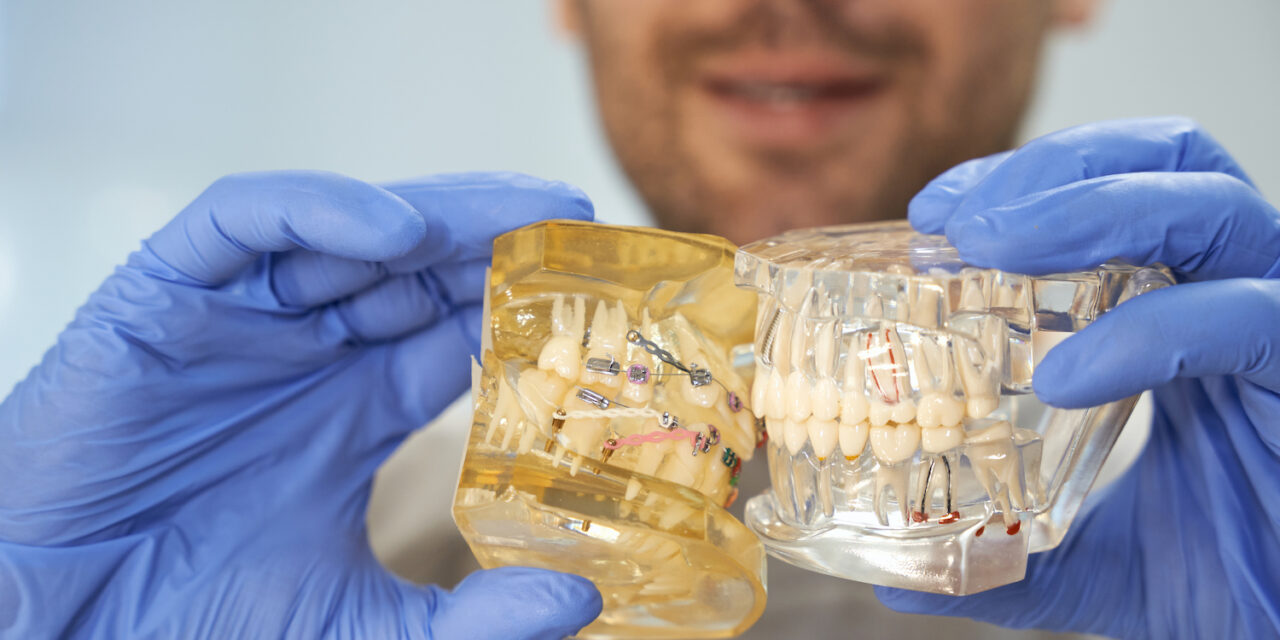 Protez Diş Türleri Nelerdir?