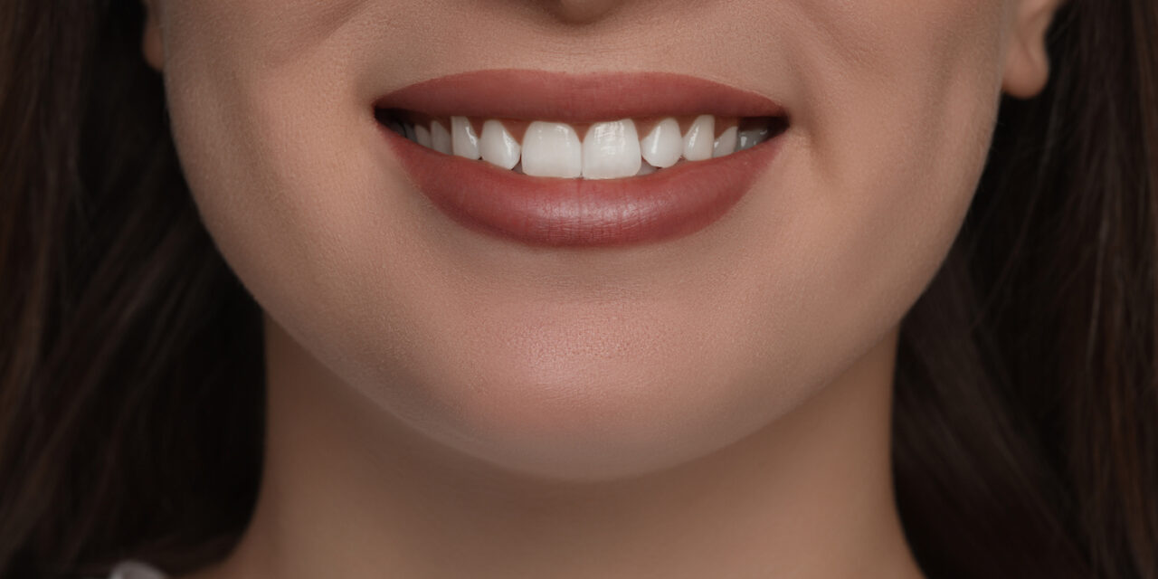 Gülüş Tasarımı Nedir? Detaylı Süreç ve Uygulama Rehberi