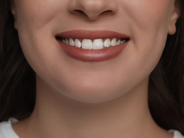 Gülüş Tasarımı Nedir? Detaylı Süreç ve Uygulama Rehberi