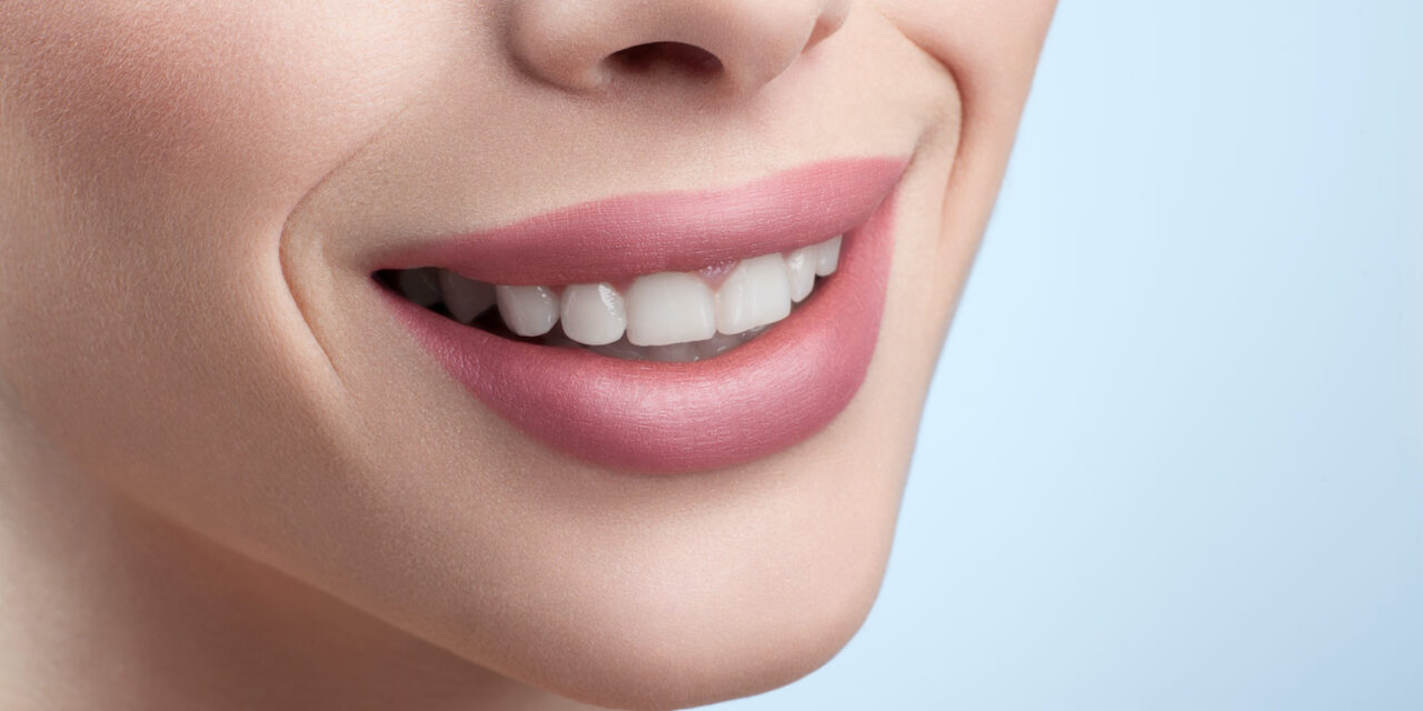 Gülüş Tasarımı Sürecinde Hangi Tedaviler Kullanılır?