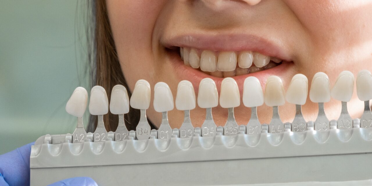 Gülüş Tasarımı Sürecinde Hangi Tedaviler Kullanılır?