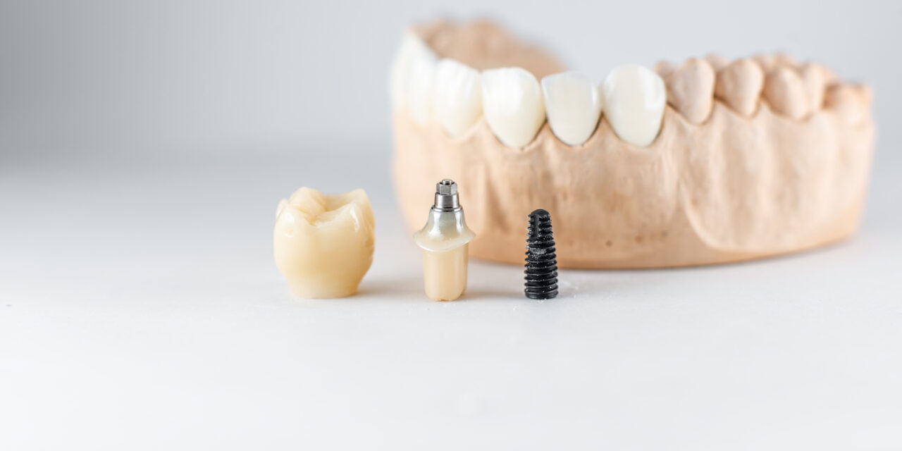 İmplant Üstü Protez Diş Nedir?