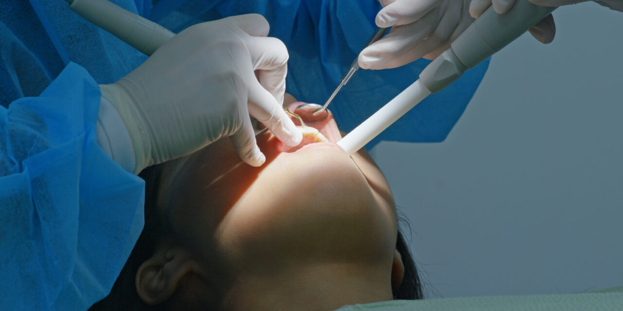 Diş Taşı Temizliği Neden Bir Lüks Değil, Temel Bir Zorunluluktur? Sessiz Tehlikeyi Anlamak