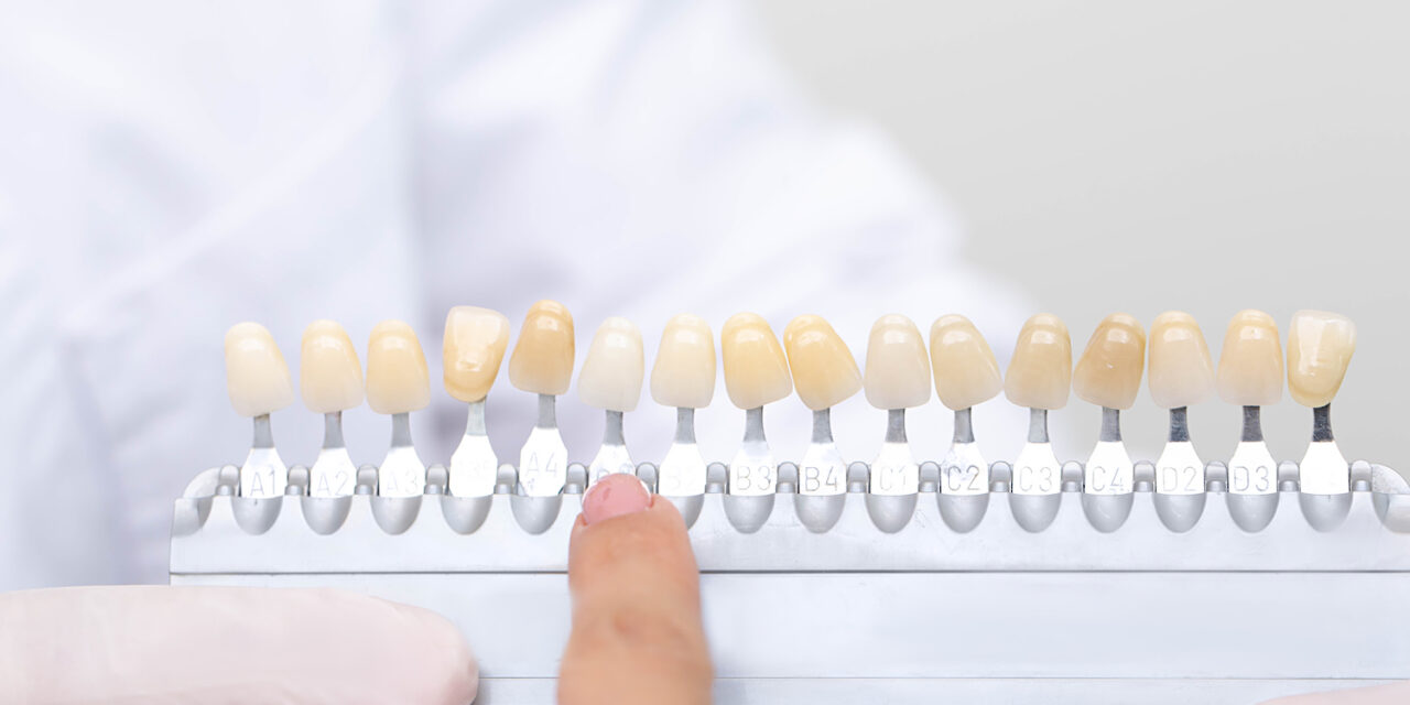 Doğal Gülüş Tasarımında Kusursuz Diş Rengi Seçimi: Biyomimetik ve Bilimsel Rehber