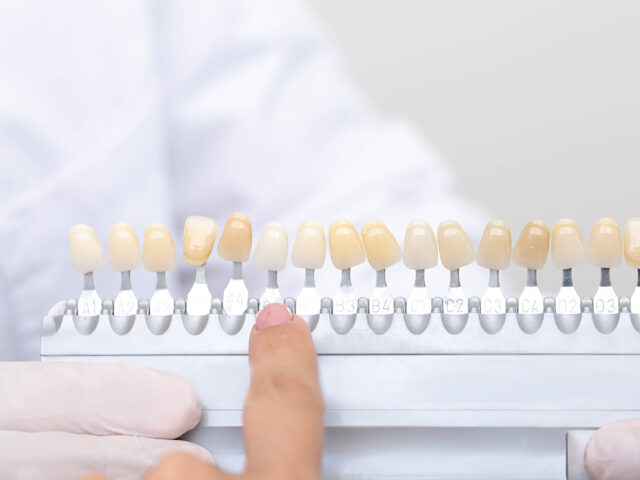 Doğal Gülüş Tasarımında Kusursuz Diş Rengi Seçimi: Biyomimetik ve Bilimsel Rehber