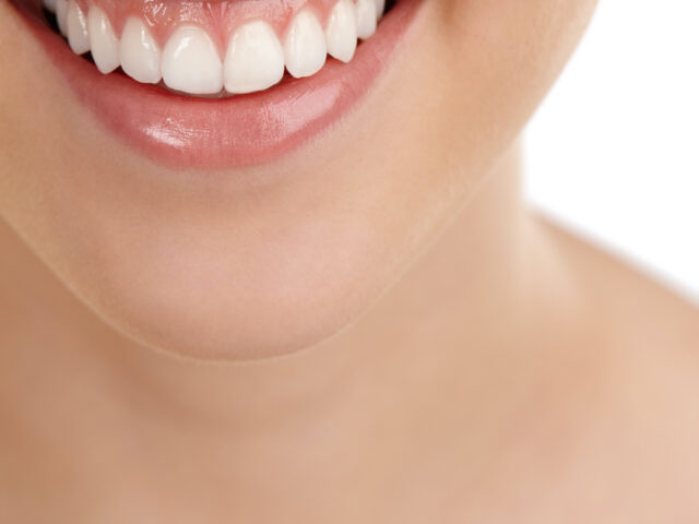 Gummy Smile (Diş Eti Gülümsemesi) Nedir? Lazerle Diş Eti Boyu Uzatma Tedavisi