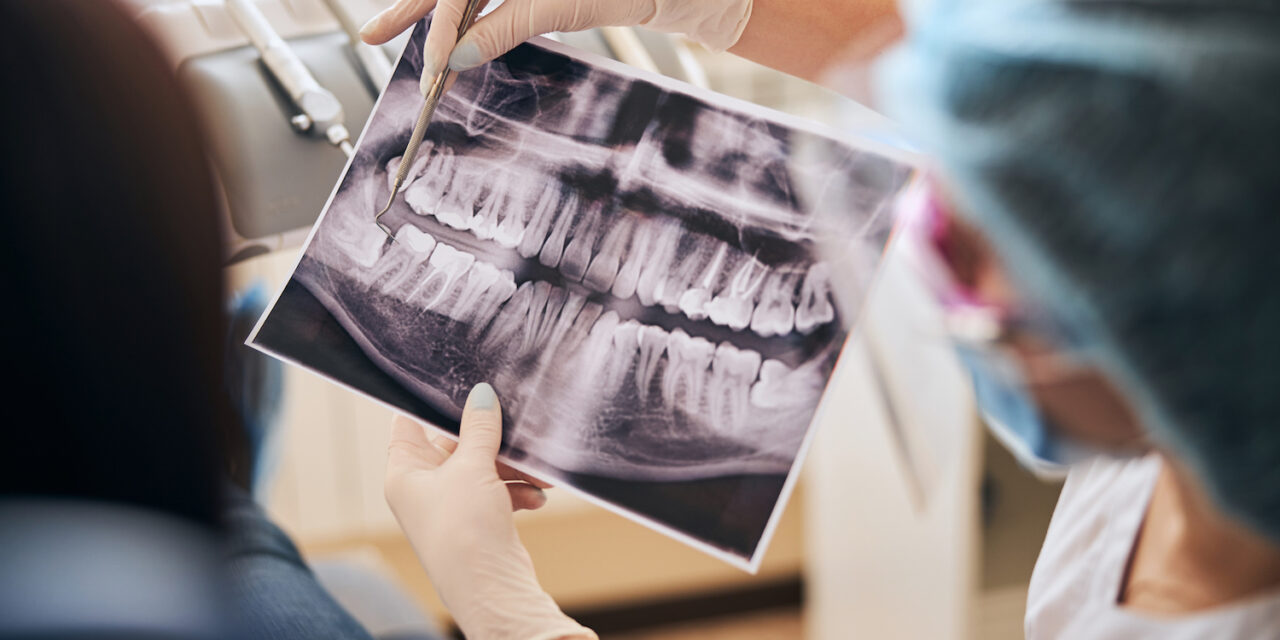 Hamilelikte Röntgen ve Diş Tedavisi Güvenli mi? Anne Adayları İçin Ağız Bakım Rehberi