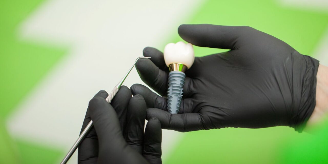 İmplant Sonrası Bakım Rehberi: Uzun Ömürlü Gülüşler İçin Altın Kurallar