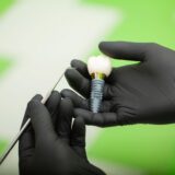 İmplant Sonrası Bakım Rehberi: Uzun Ömürlü Gülüşler İçin Altın Kurallar