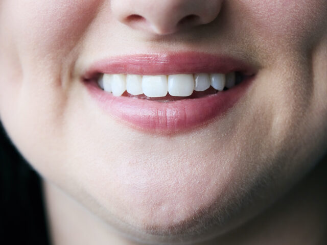 Zirkonyum ve Tam Seramik Diş Kaplama: Doğal Gülüş Tasarımında Mükemmellik ve Biyouyum