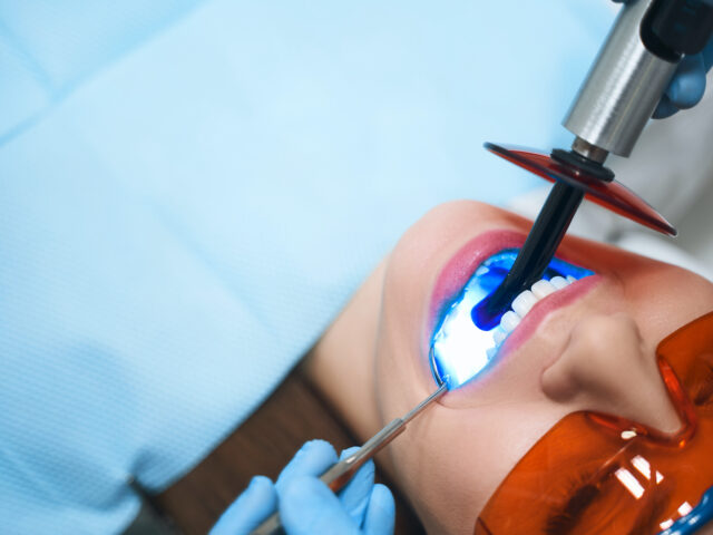Diş Beyazlatma (Bleaching) Hakkında Doğru Bilinen Yanlışlar ve Evde Yapılan Hatalar